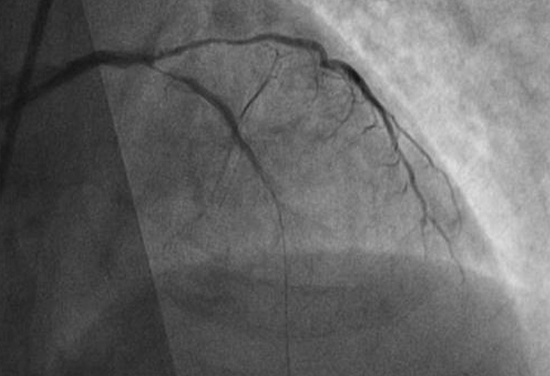 GEFÄSSPRAXIS München-Süd, Bluthochdruck Grünwald, Infusionen Grünwald, Internist Grünwald, Internist Isartal