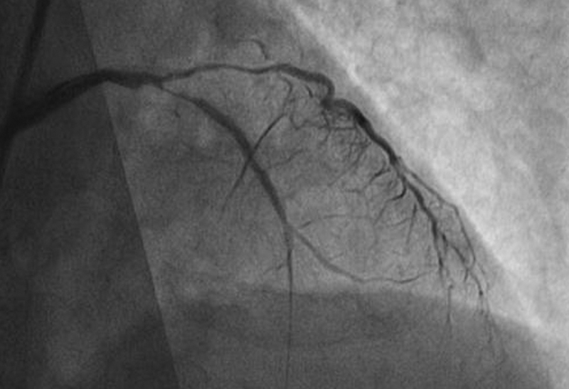 GEFÄSSPRAXIS München-Süd, Bluthochdruck Grünwald, Infusionen Grünwald, Internist Grünwald, Internist Isartal